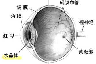 白内障手術