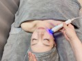 【美顔コース】小顔フェイシャル＋ラジオ波＋EMS＋ヒト幹細胞導入60分
